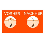 Bump Eraiser Triple Action Lotion 125 ml, Sunzze